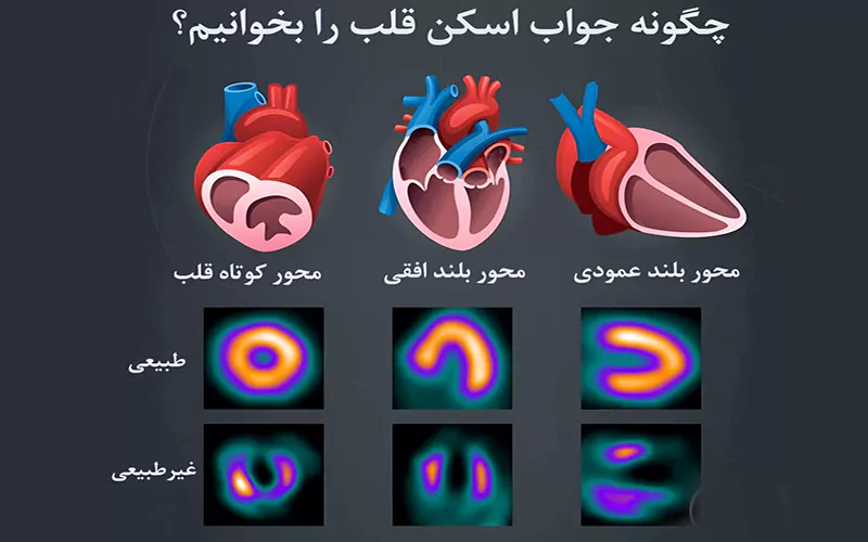 چگونه جواب اسکن قلب را بخوانیم
